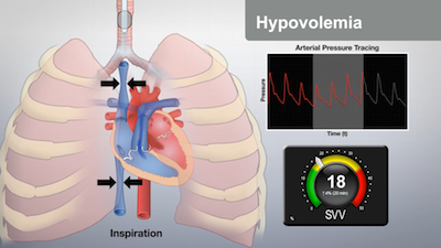 V&iacute;deo do YouTube